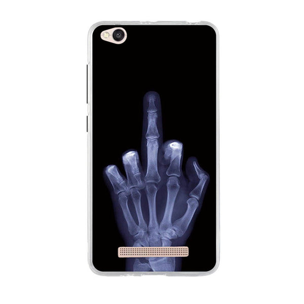 Xiaomi Phone Case