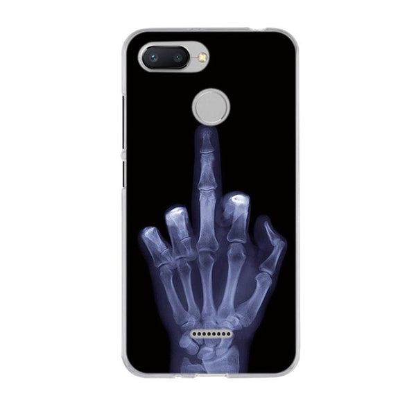 Xiaomi Soft Silicone Case